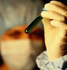 как сдавать анализы на наличие паразитов